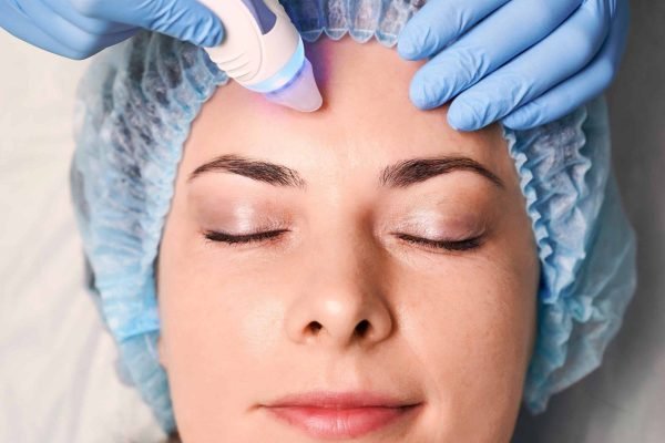 BB Glow Nano Needling at Lilly Beauty